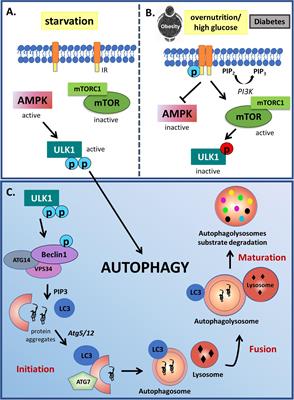 Insulin and Autophagy in Neurodegeneration